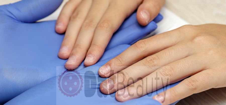 Reasons of Damaged nails under acrylics